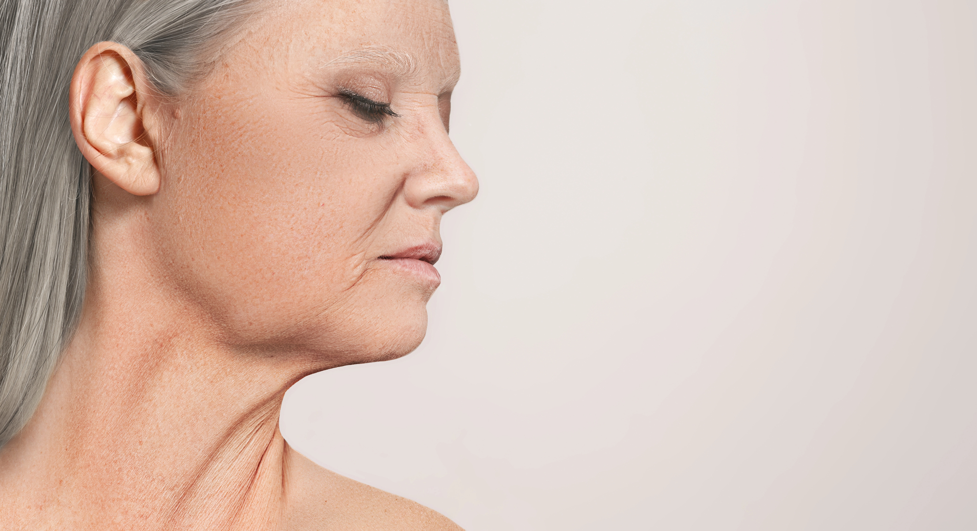 O kirurškem dvigu ustnice